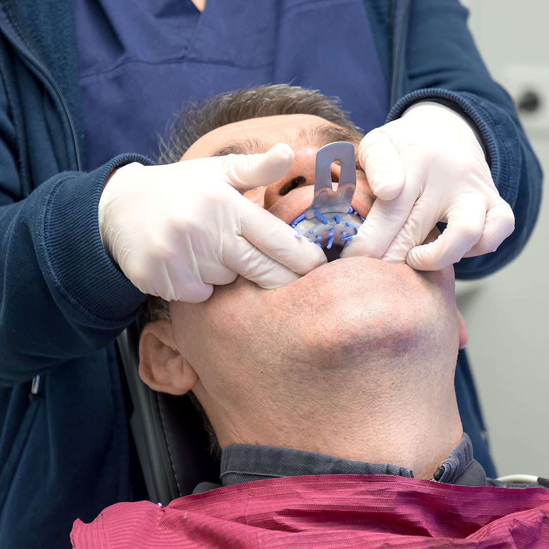 Artistic Family Dental | Oral Cancer Screening, Veneers and Digital Impressions